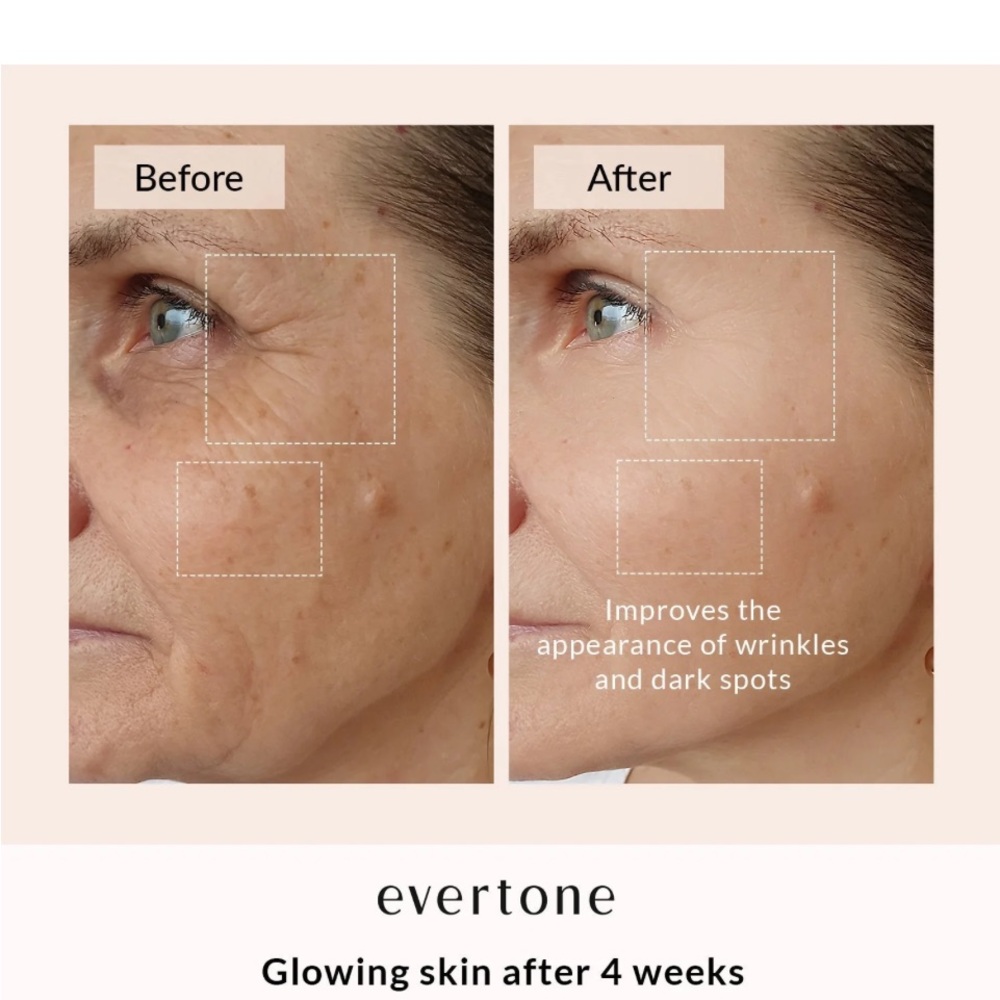 Great used condition, Evertone OMNIGLOW LED FACE & Neck mask. 7 LED colors - Picture 9 of 12